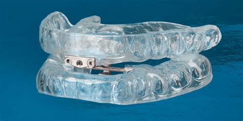 adjustable sleep apnea mouthpiece ray hadley